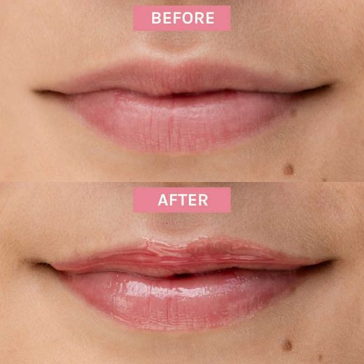 Image of Evolve Bio-Retinol Glossy Lip Oil (15ml)