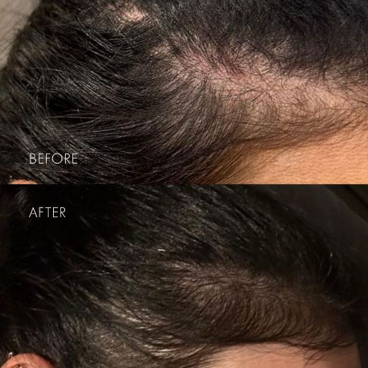 Immagine di Sweed The Hair Serum (6ml)